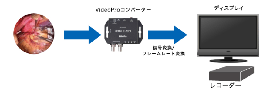 数量は多】 nakasyou-storeMEDIAEDGE メディアエッジ ANALOG to HDMI SDIコンバーター アップ ダウンコンバート  フレームレート 変換対応モデ